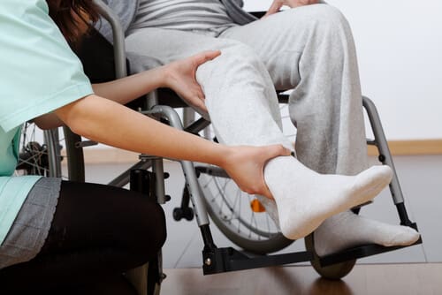 personal injury - injured leg in wheelchair